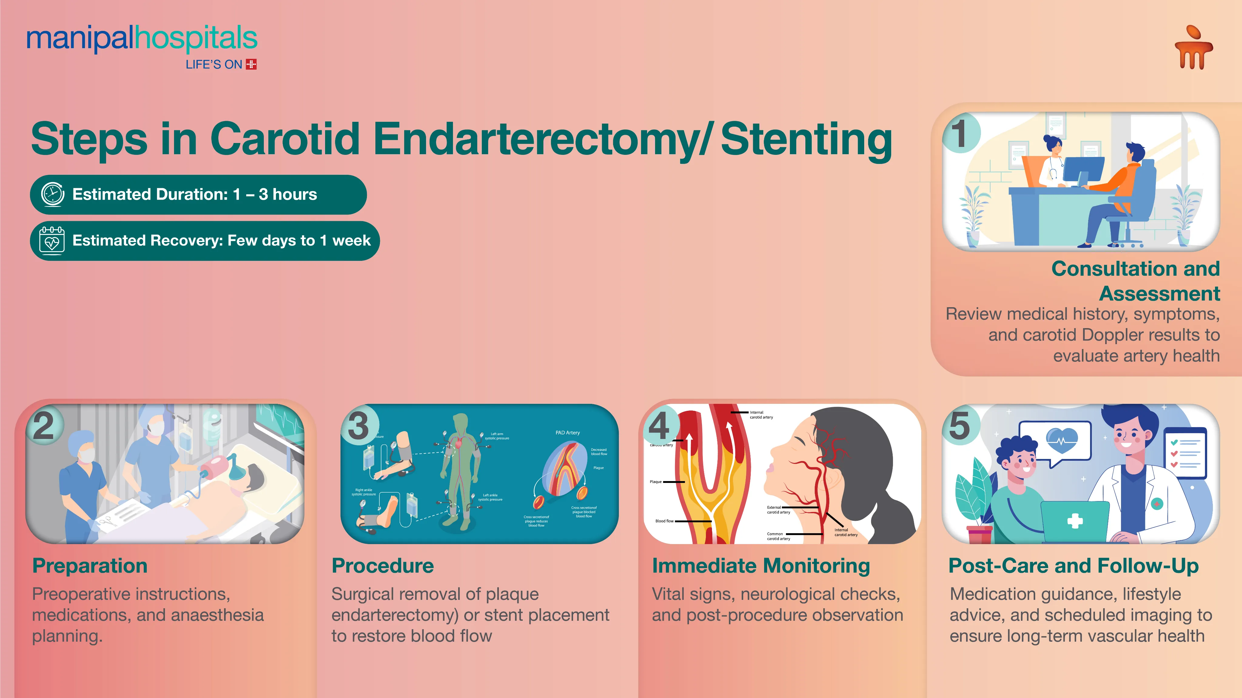 Carotid Doppler Test in Delhi | Manipal Hospitals
