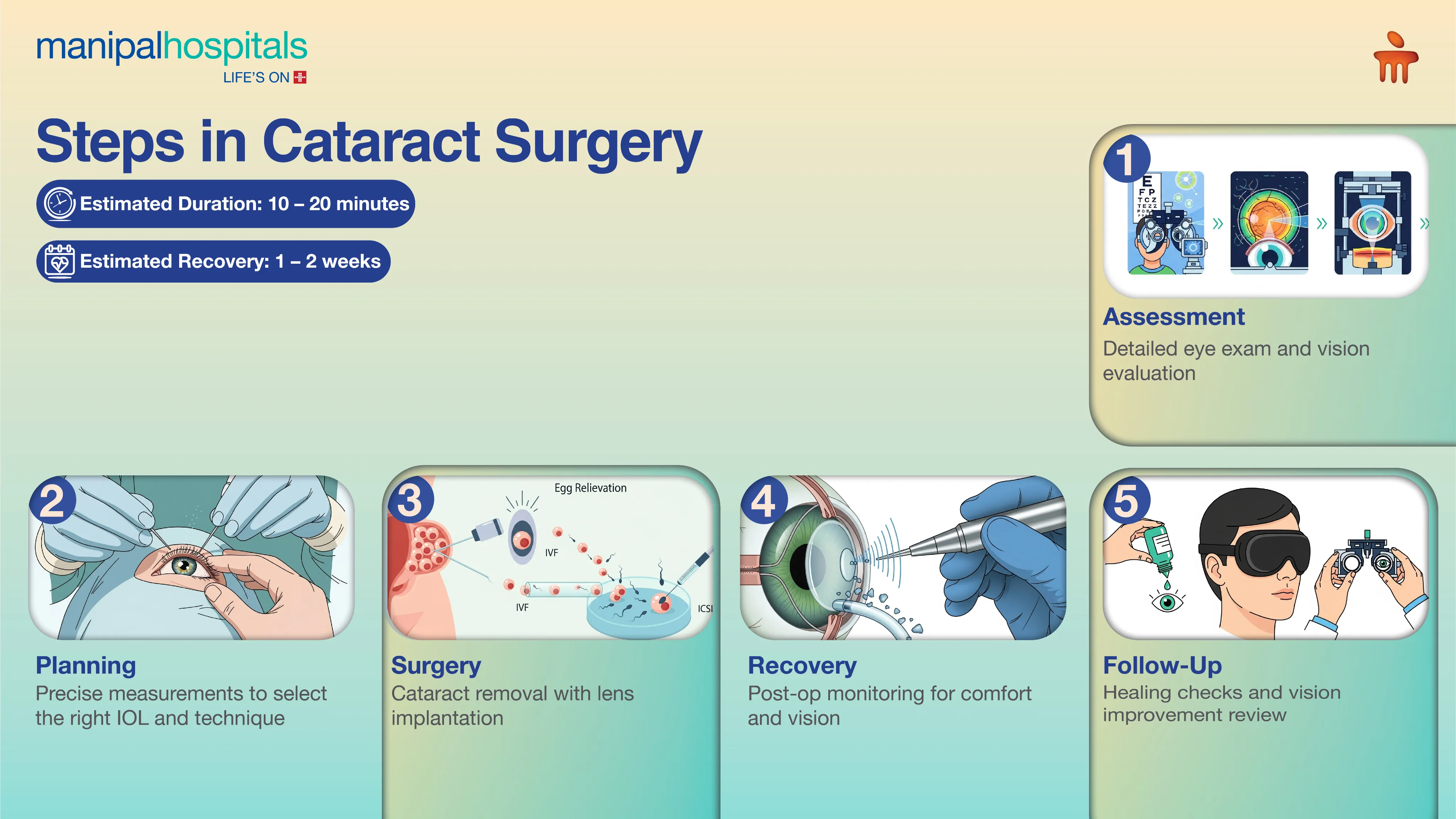 Cataract Surgery in India | Manipal Hospitals