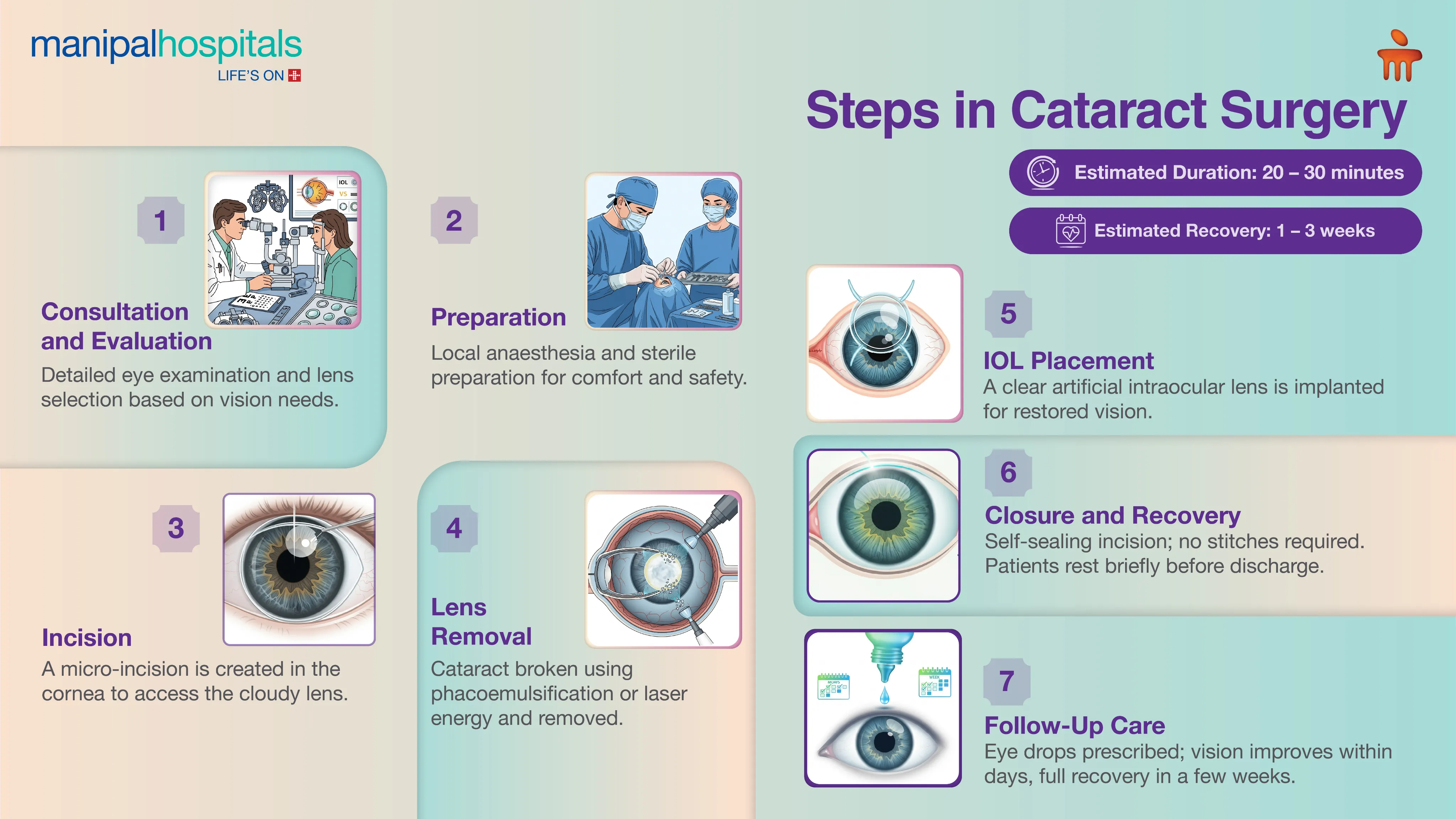 Advanced Cataract Surgery in Delhi | Manipal Hospitals