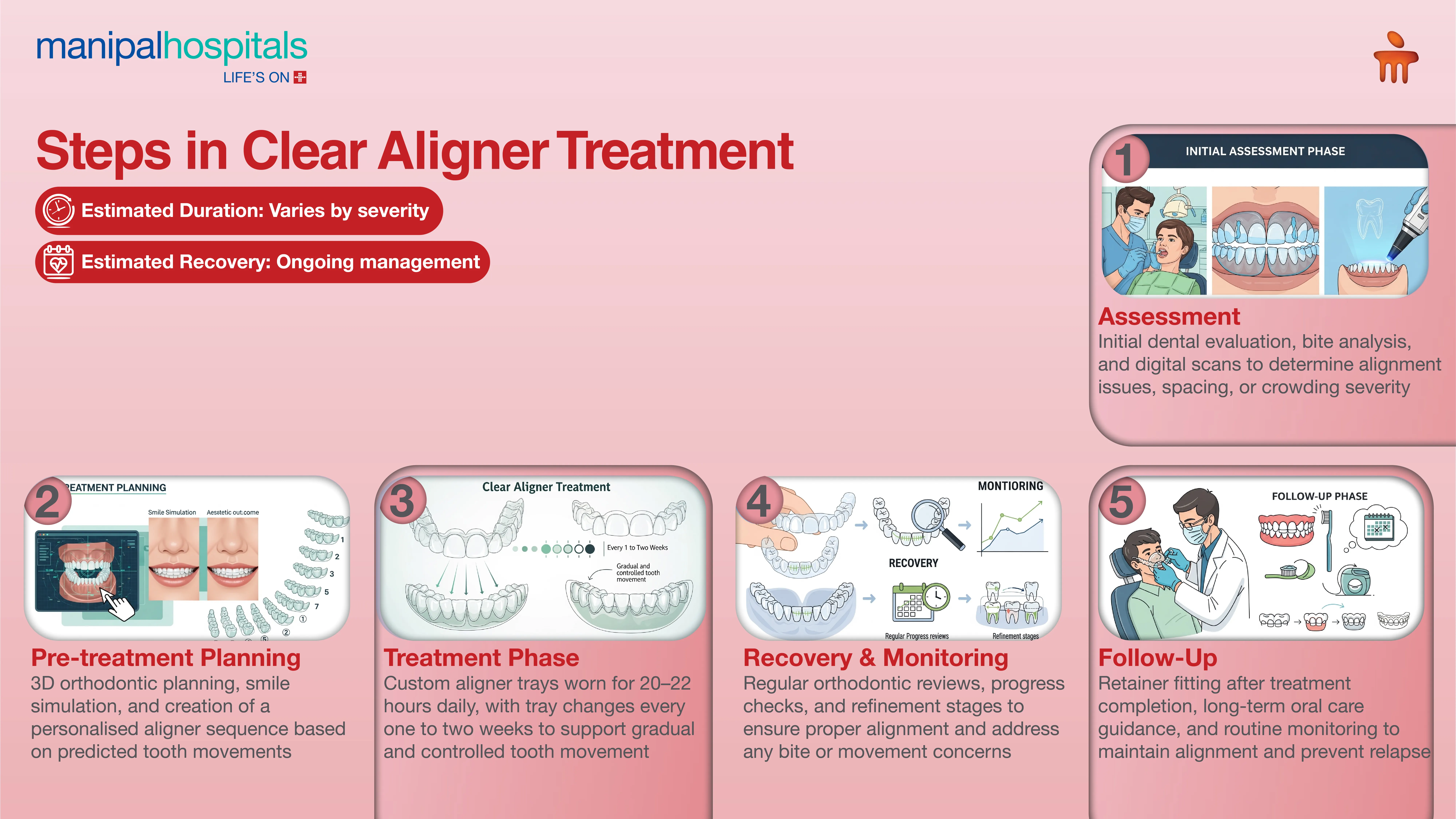Clear Aligners Treatment in India | Manipal Hospitals