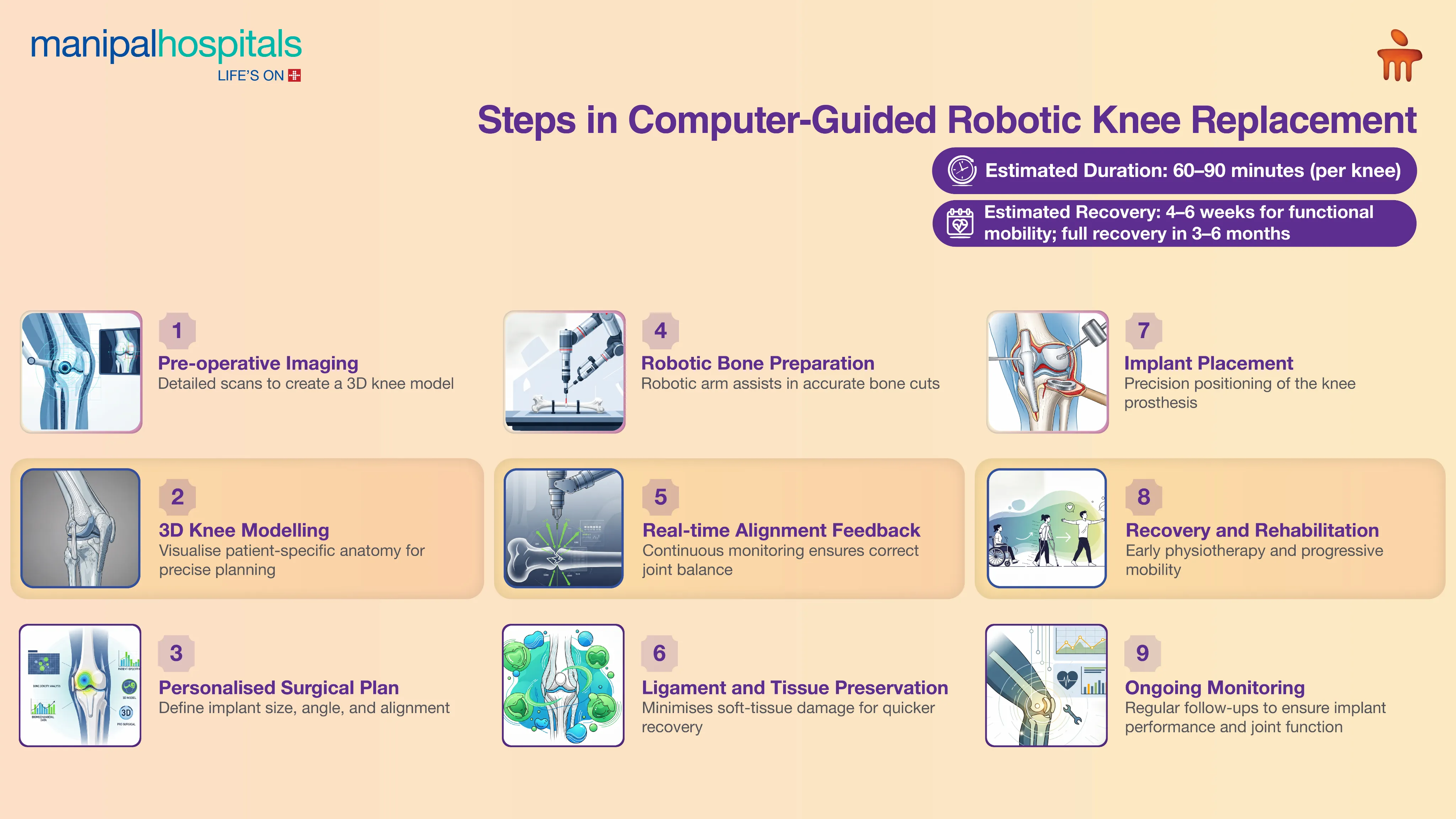Robotic Knee Replacement in Delhi | Manipal Hospitals