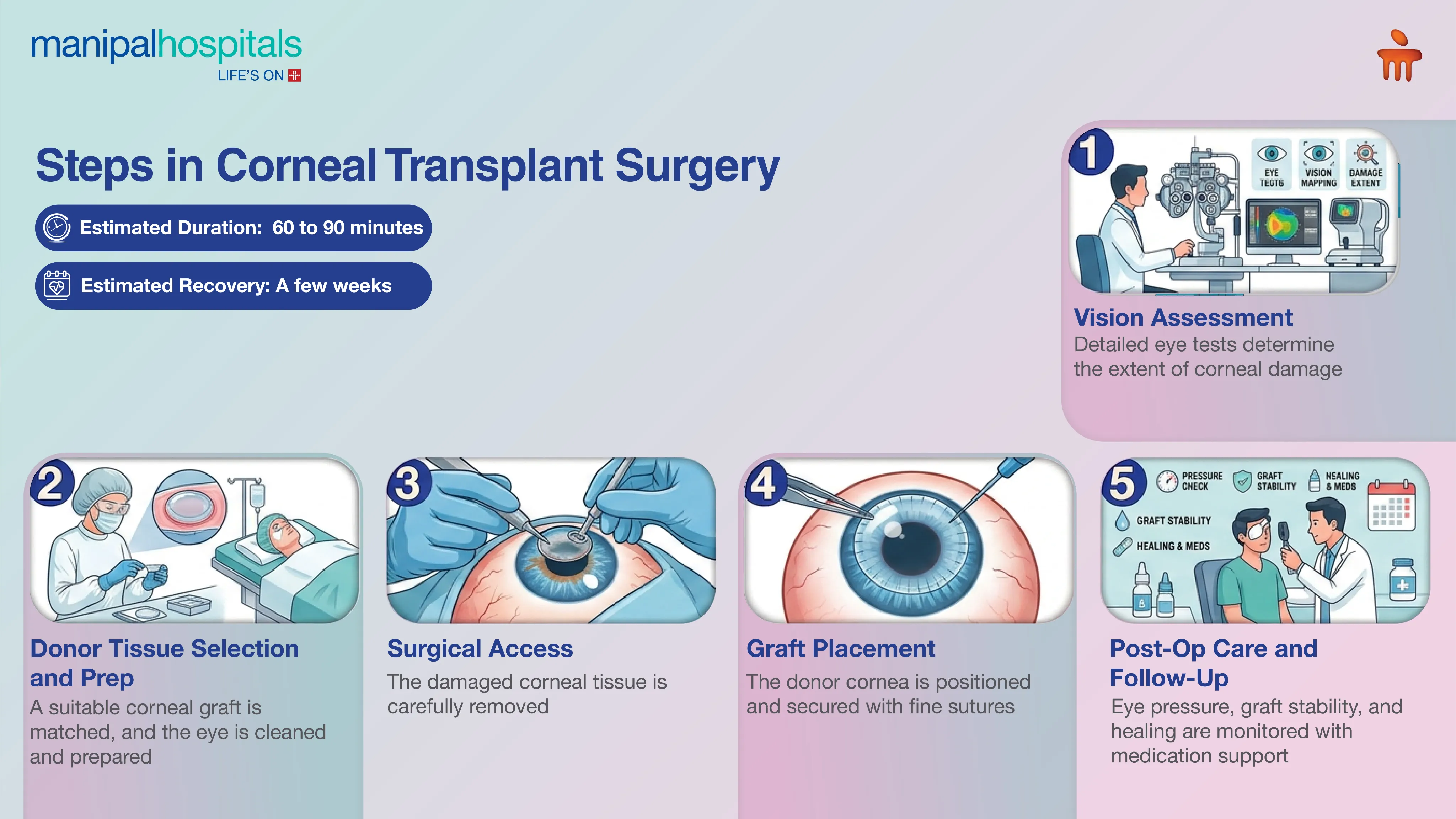 Corneal Transplant Surgery in India | Manipal Hospitals