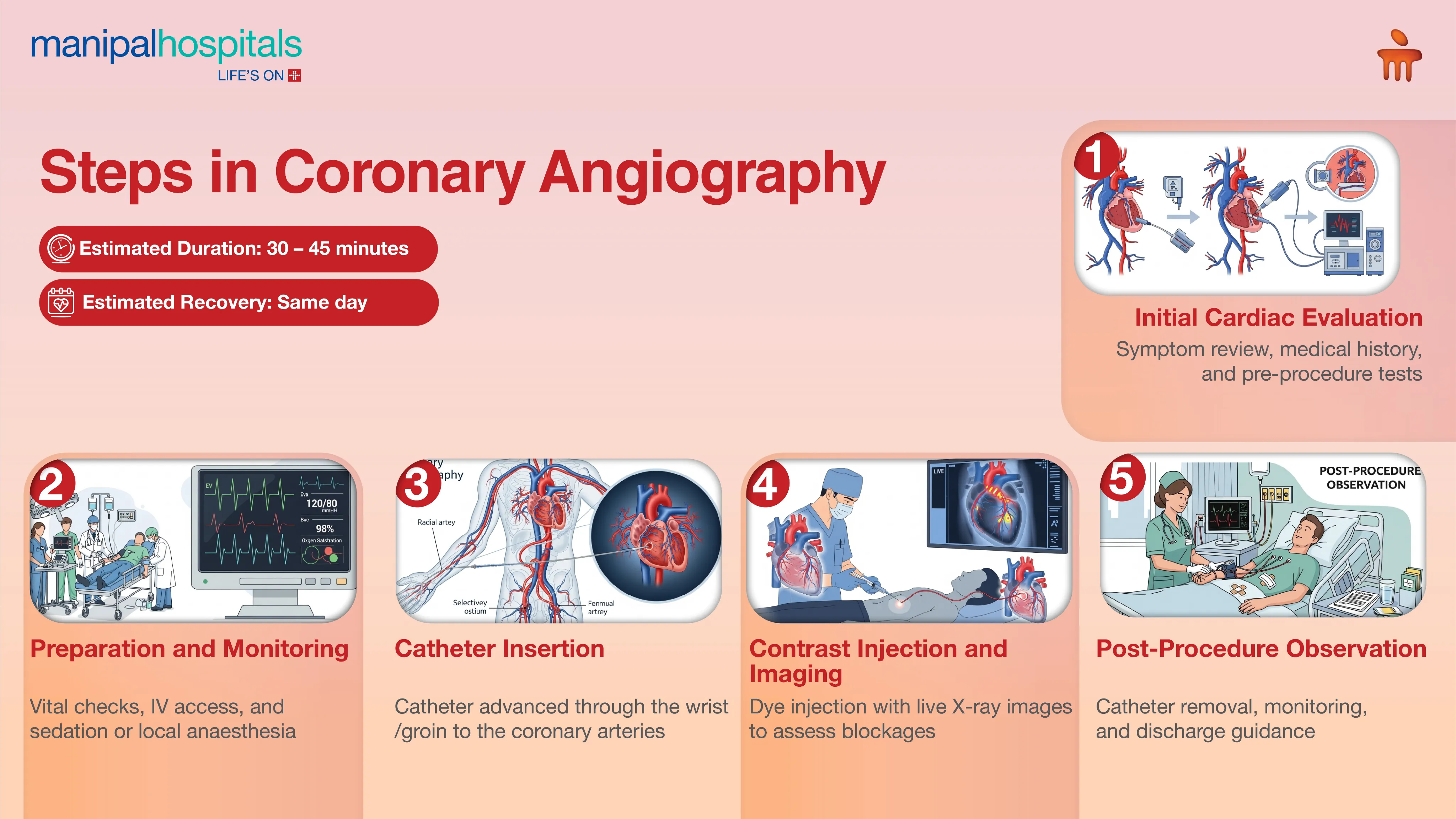 Best Coronary Angiography in Kolkata | Manipal Hospitals
