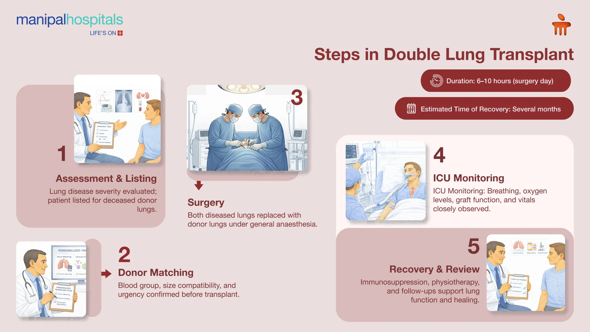 Lung Transplant in Bangalore | Manipal Hospitals