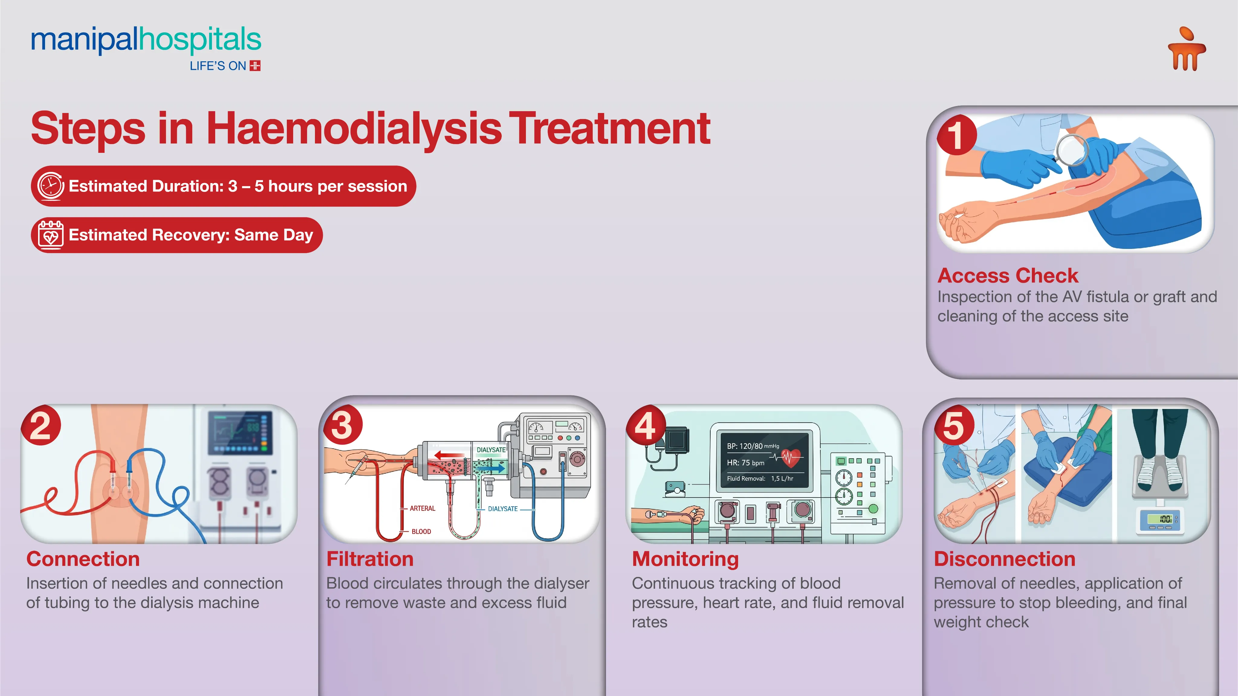 Hemodialysis Treatment in India | Manipal Hospitals