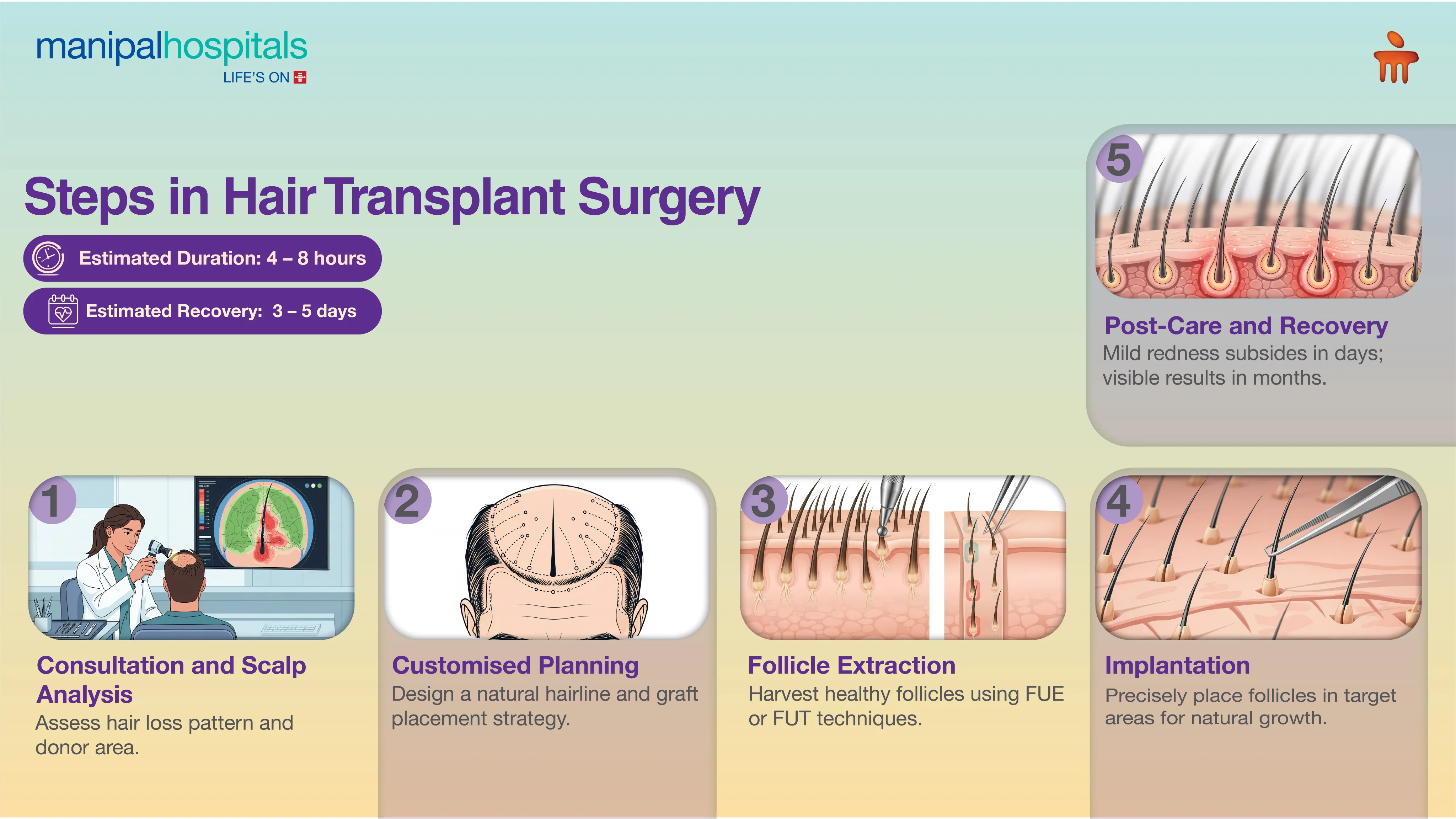 Advanced Hair Transplant Surgery in Kolkata | Manipal Hospitals