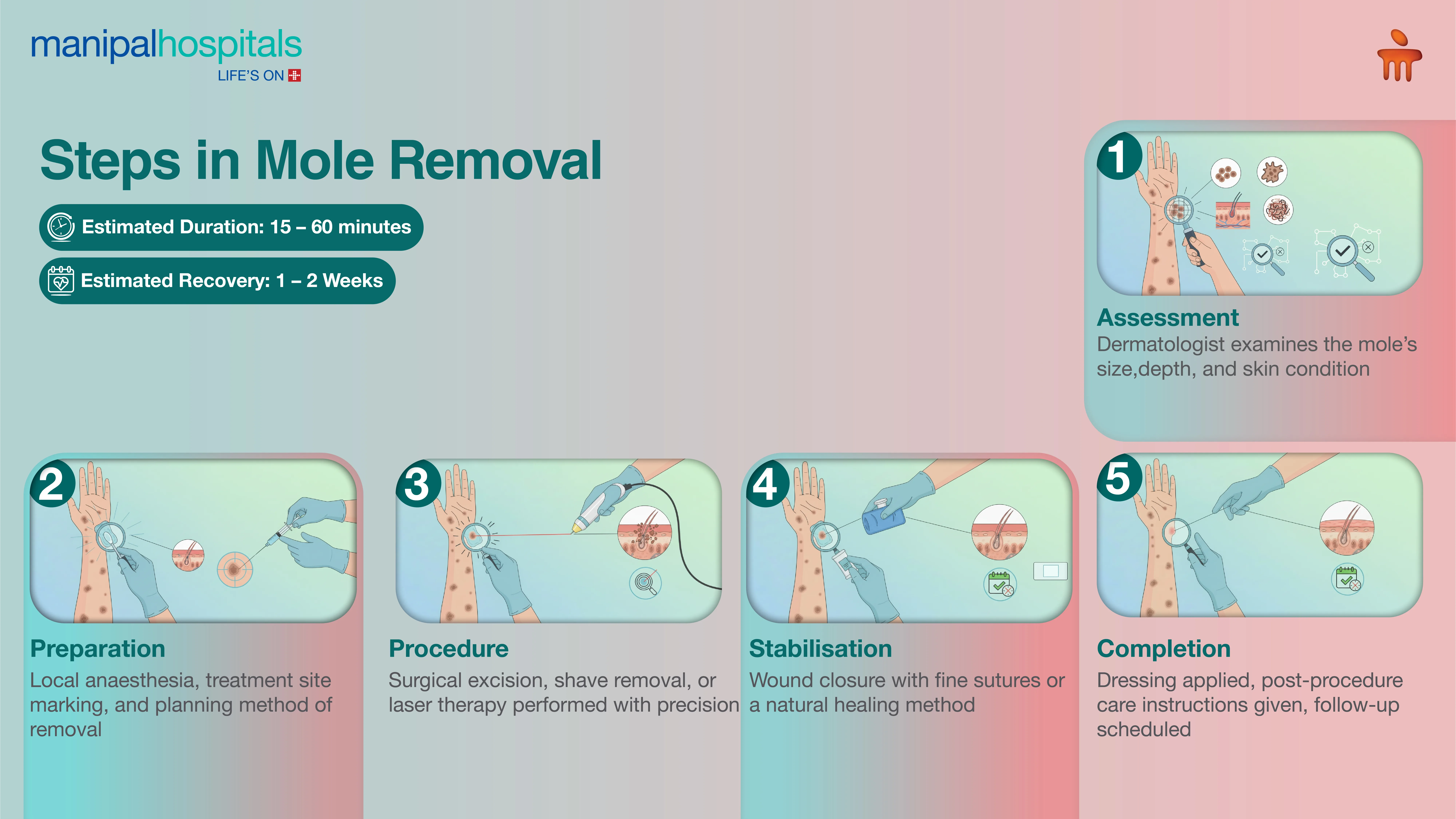 Mole Removal Surgery in India | Manipal Hospitals
