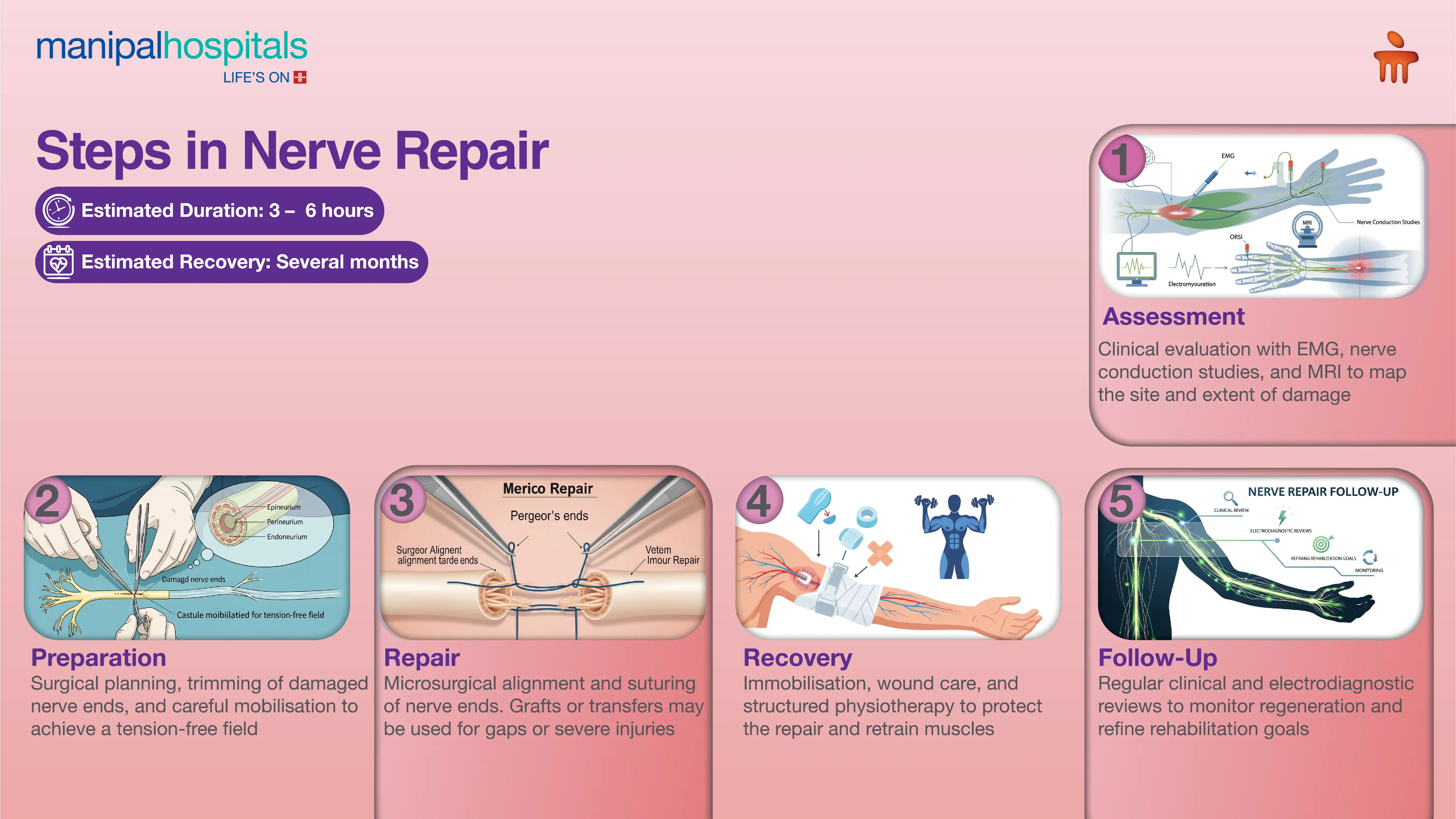 Nerve Repair Surgery in India | Manipal Hospitals