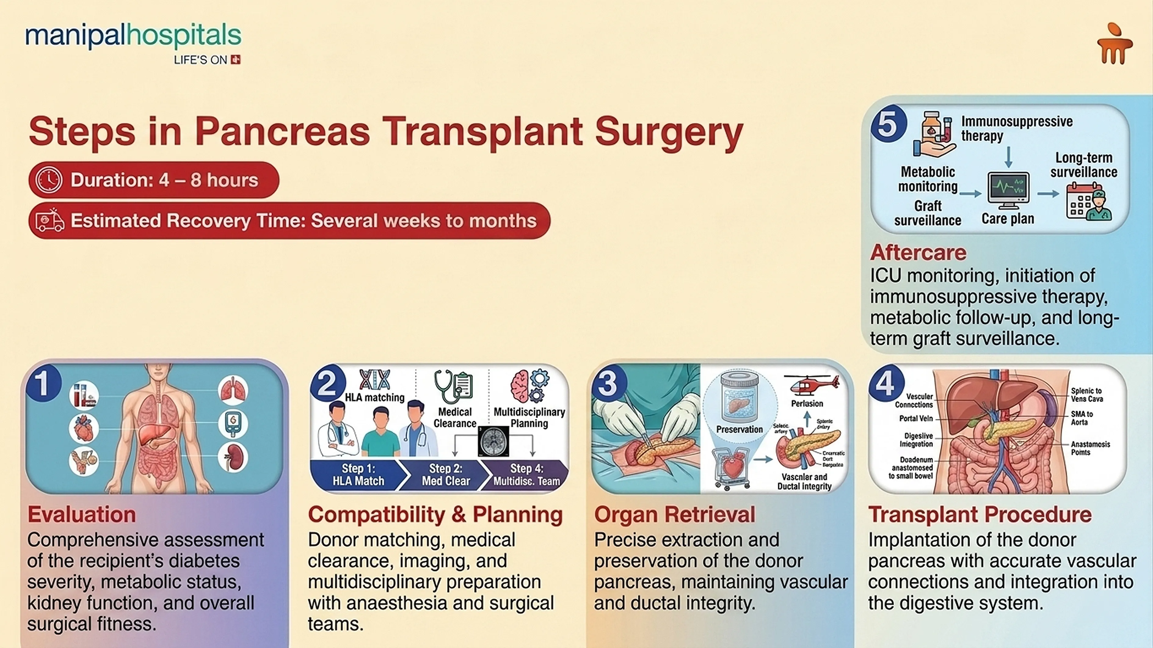 Pancreas Transplant Surgery in India | Manipal Hospitals