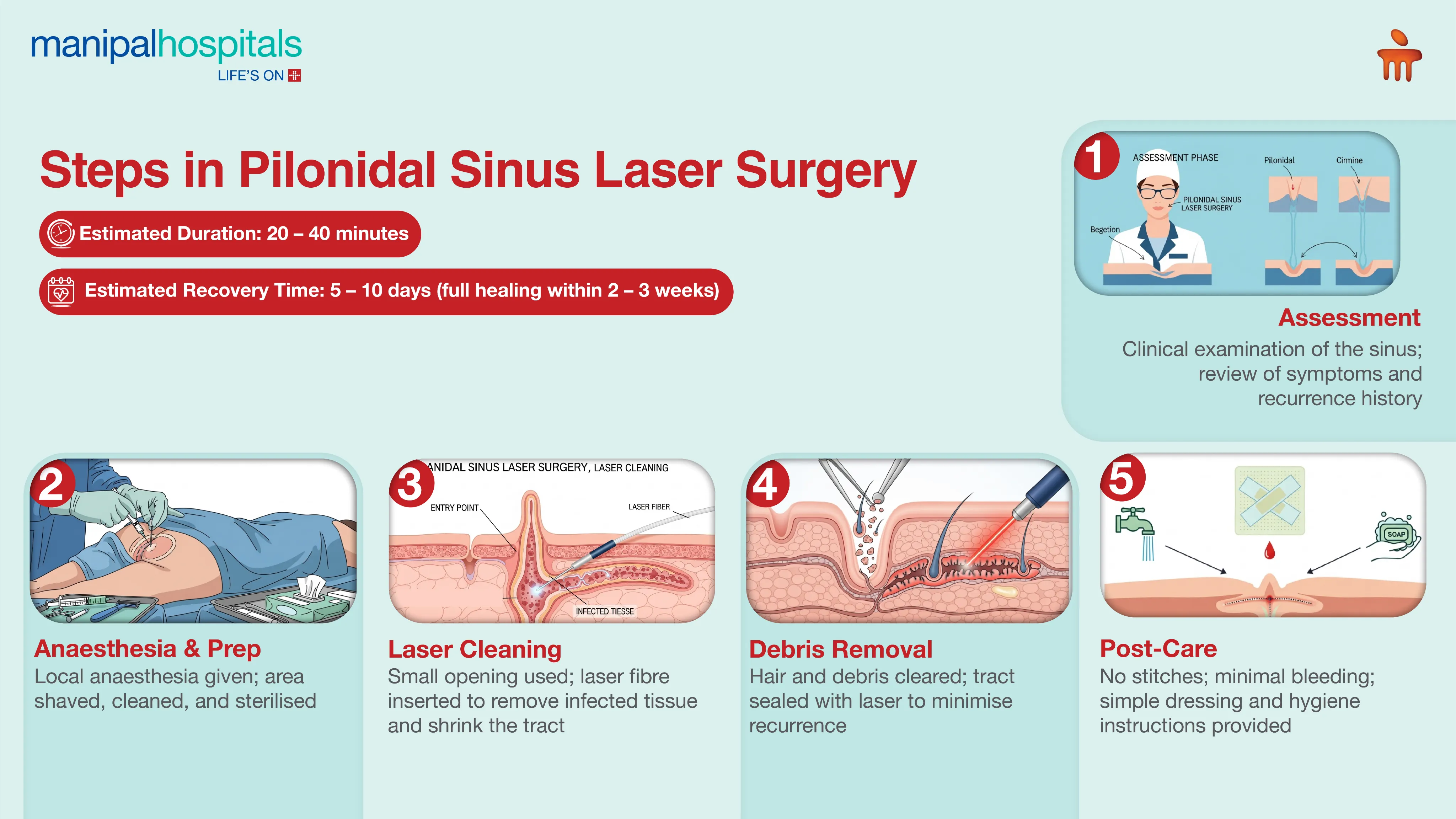 Pilonidal Sinus Laser Surgery in Kolkata | Manipal Hospitals