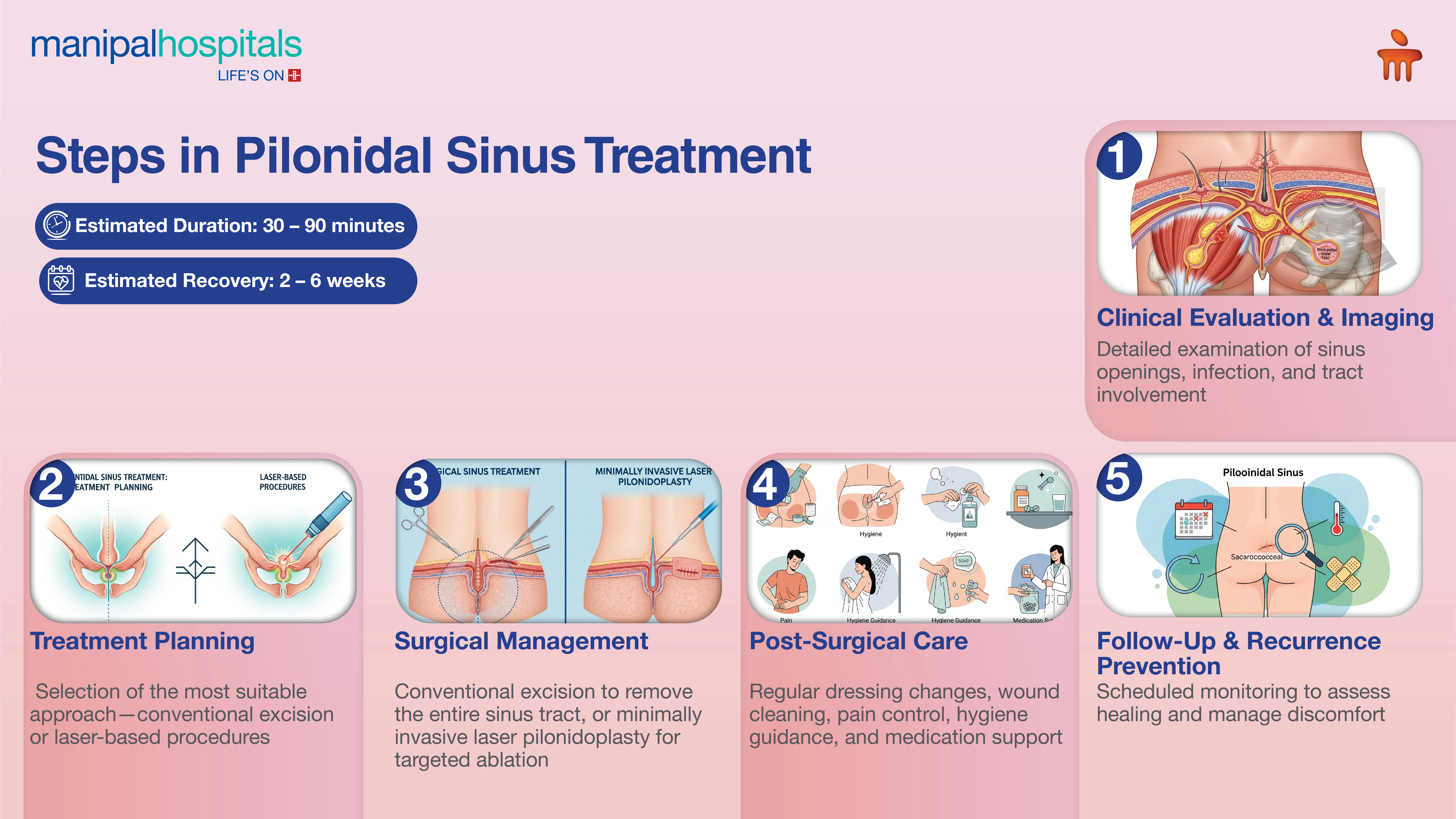 Pilonidal Sinus Surgery in India | Manipal Hospitals