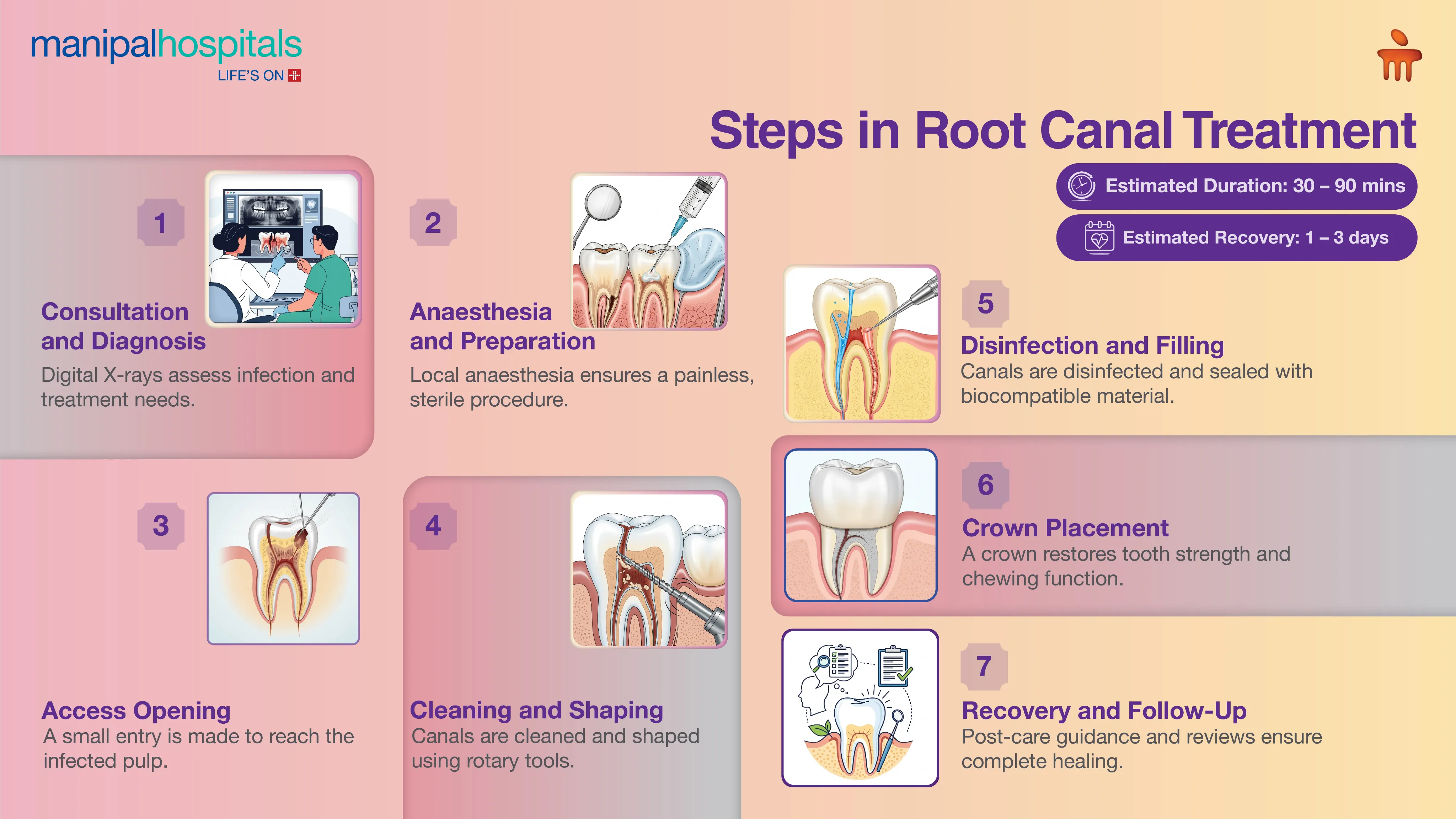 Root Canal Treatment in Delhi | Manipal Hospitals