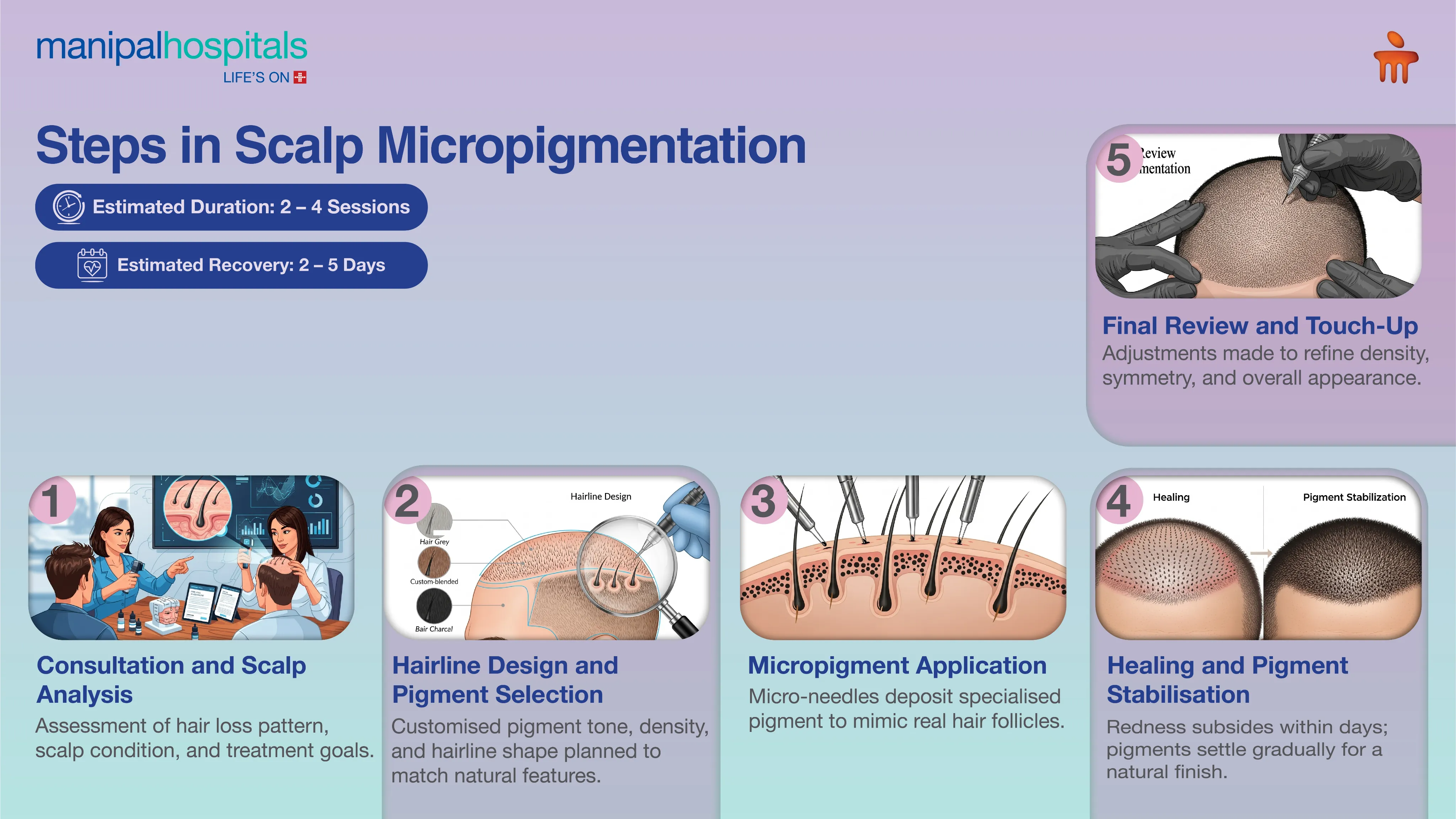 Scalp Micropigmentation in Delhi | Manipal Hospitals