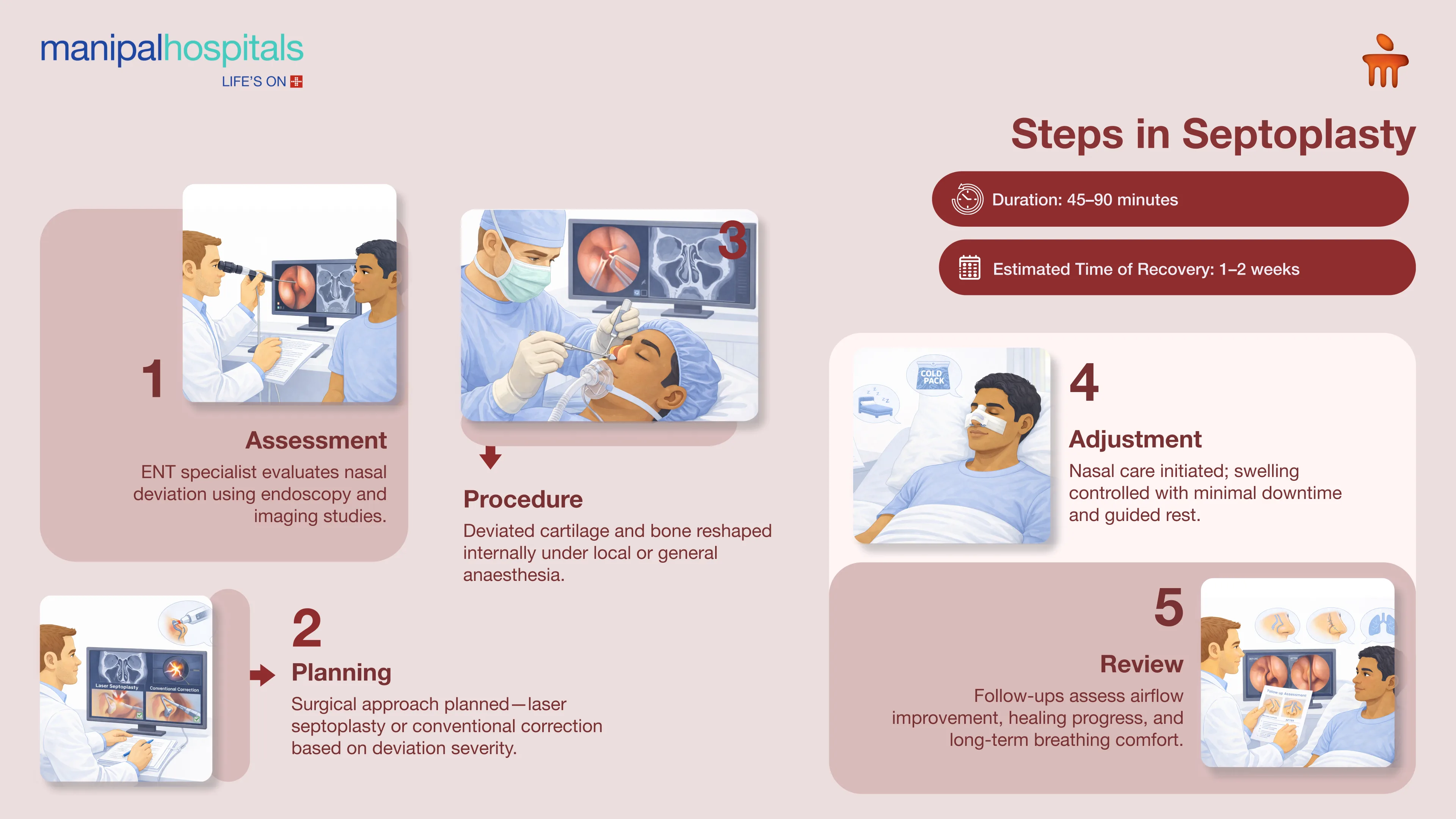 Septoplasty in Bangalore | Manipal Hospitals