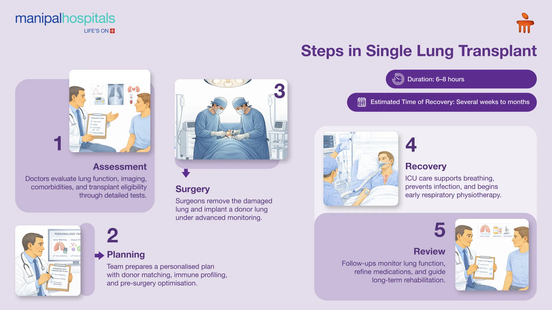 Lung Transplant in Bangalore | Manipal Hospitals