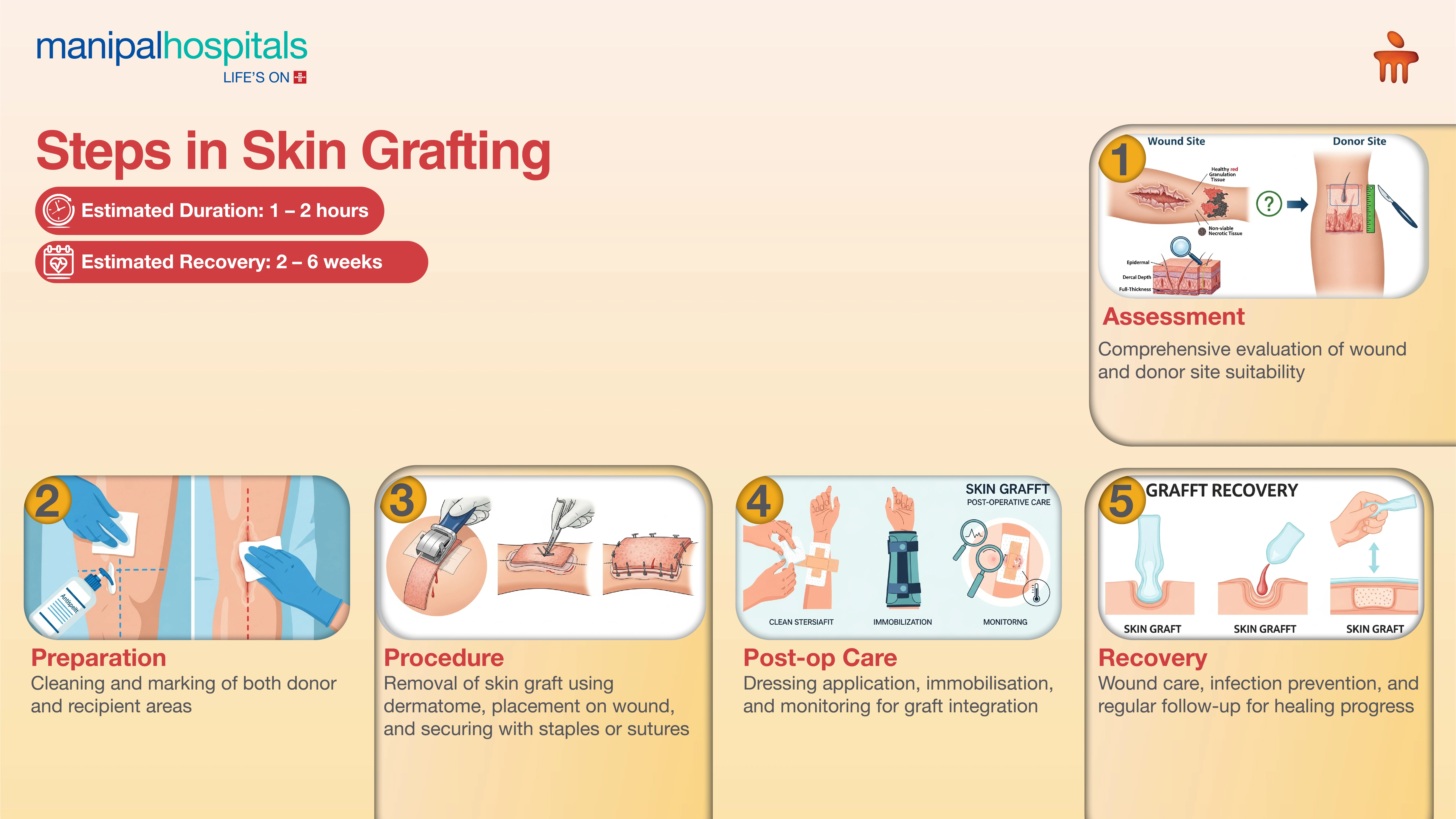 Skin Grafting Surgery in India | Manipal Hospitals