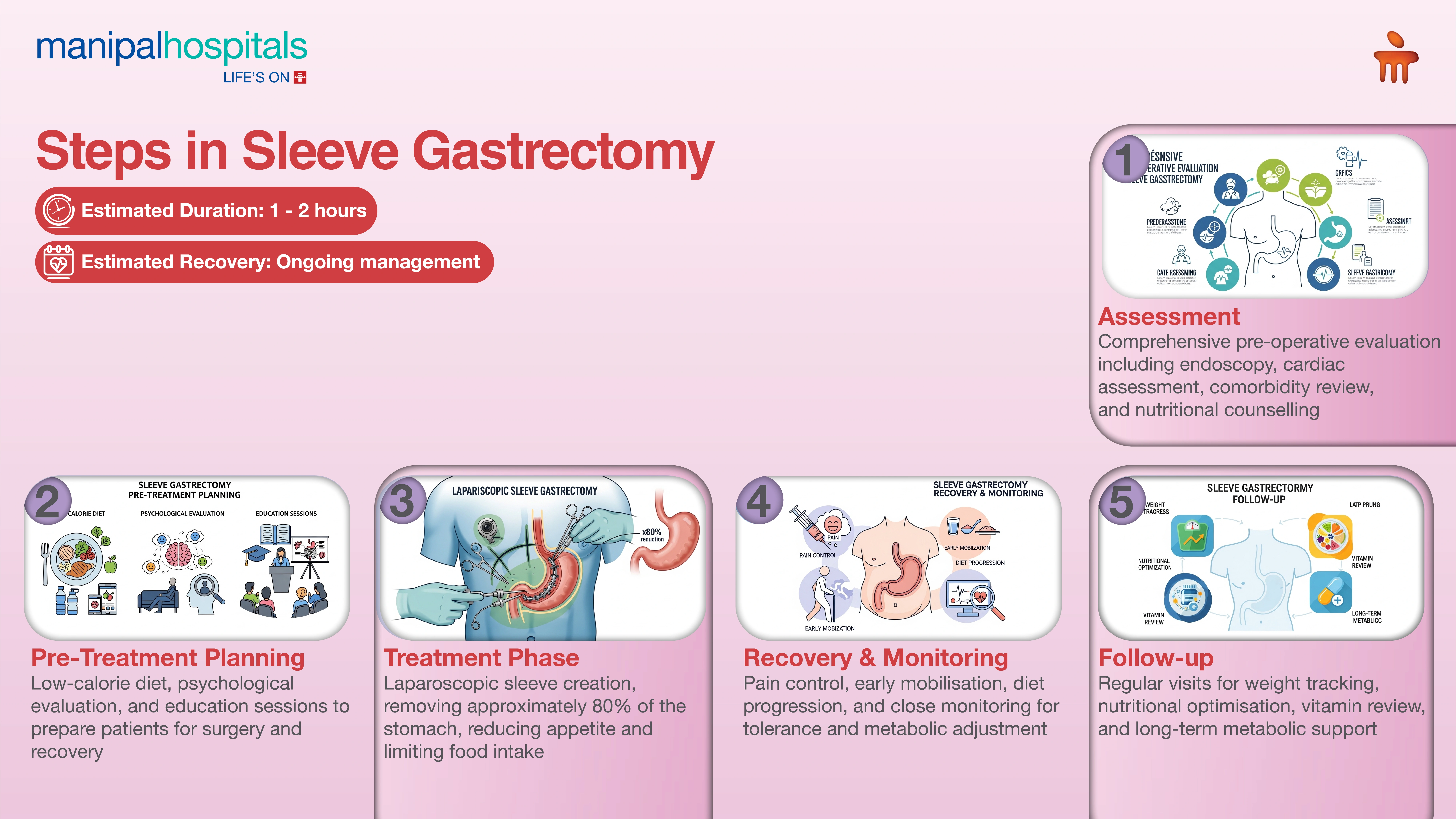 Sleeve Gastrectomy Surgery in India | Manipal Hospitals