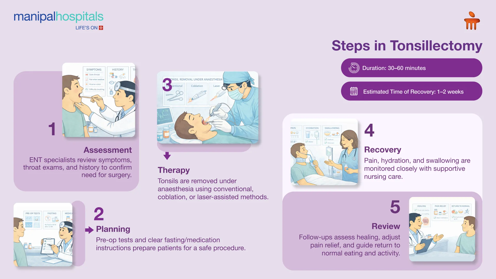 Tonsillectomy in Bangalore | Manipal Hospitals