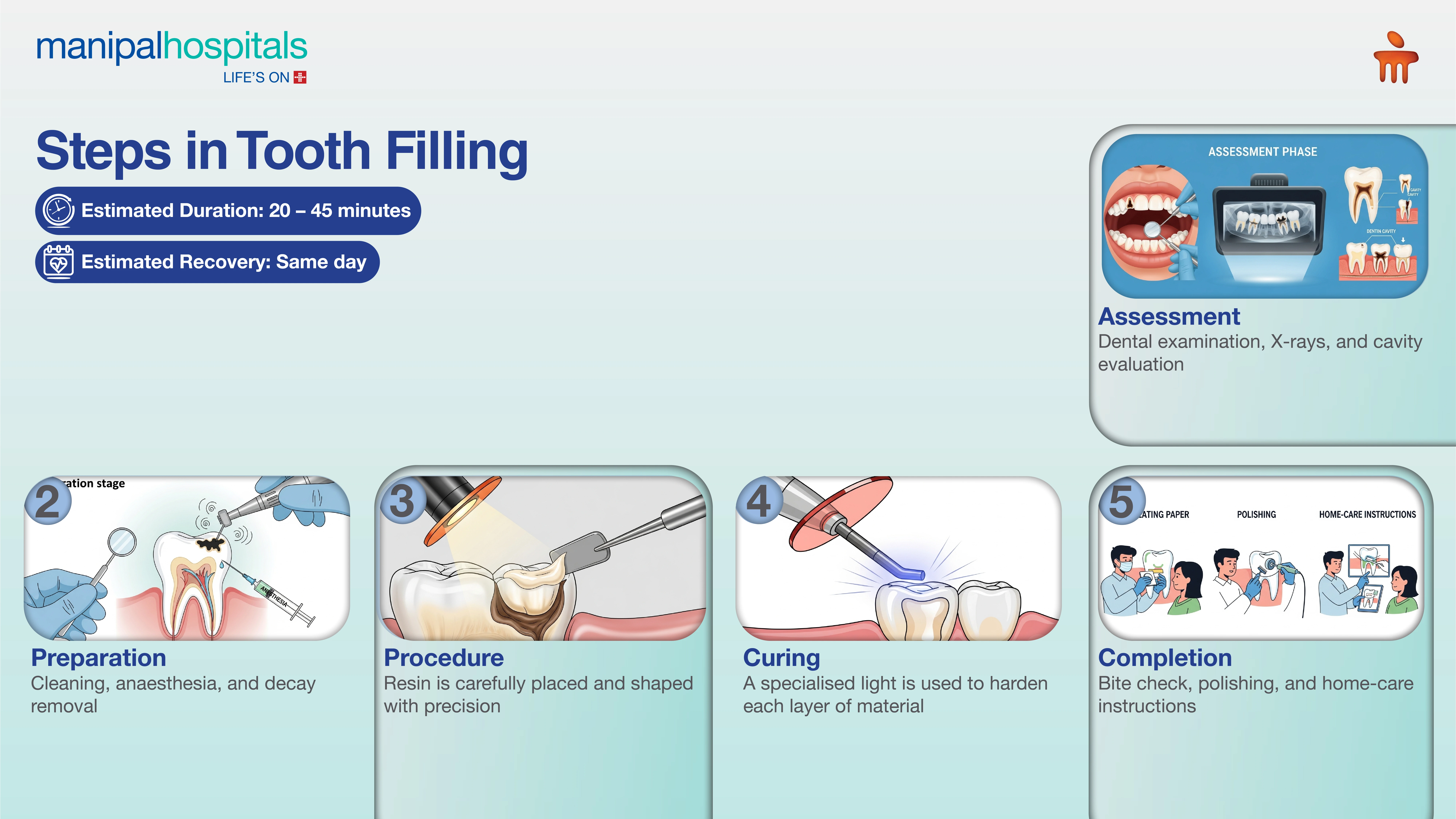 Tooth Filling Treatment in India | Manipal Hospitals