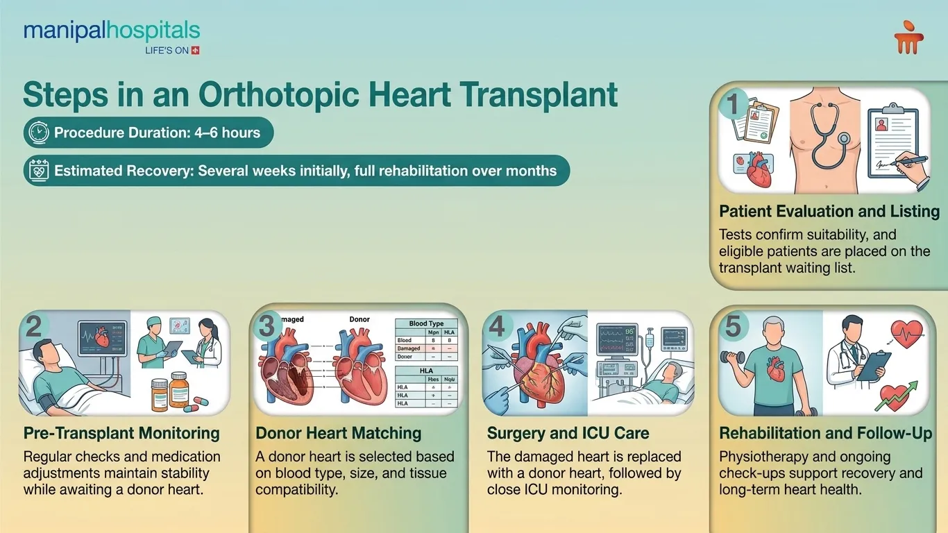 Orthotopic Heart Transplant in India | Manipal Hospitals