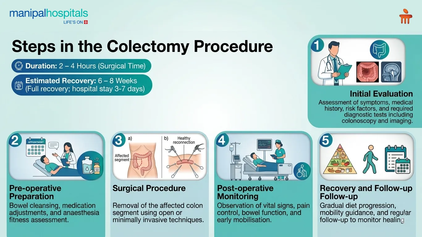 Colectomy Surgery in India | Manipal Hospitals
