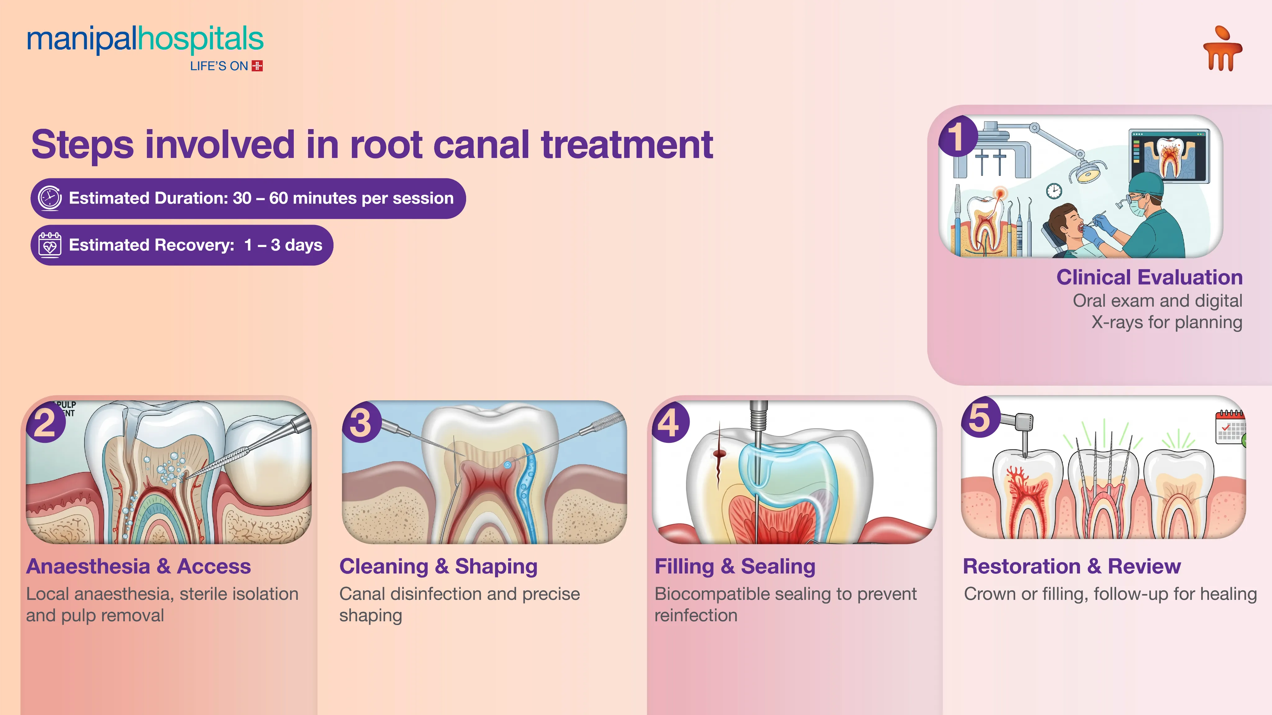 Advanced Root Canal Treatment in Kolkata | Manipal Hospitals