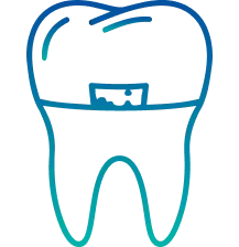 Tooth Filling Treatment in India | Manipal Hospitals