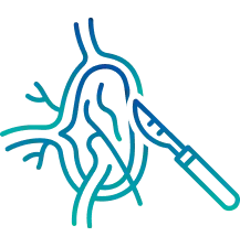 Varicocele Surgery in Bangalore | Manipal Hospitals