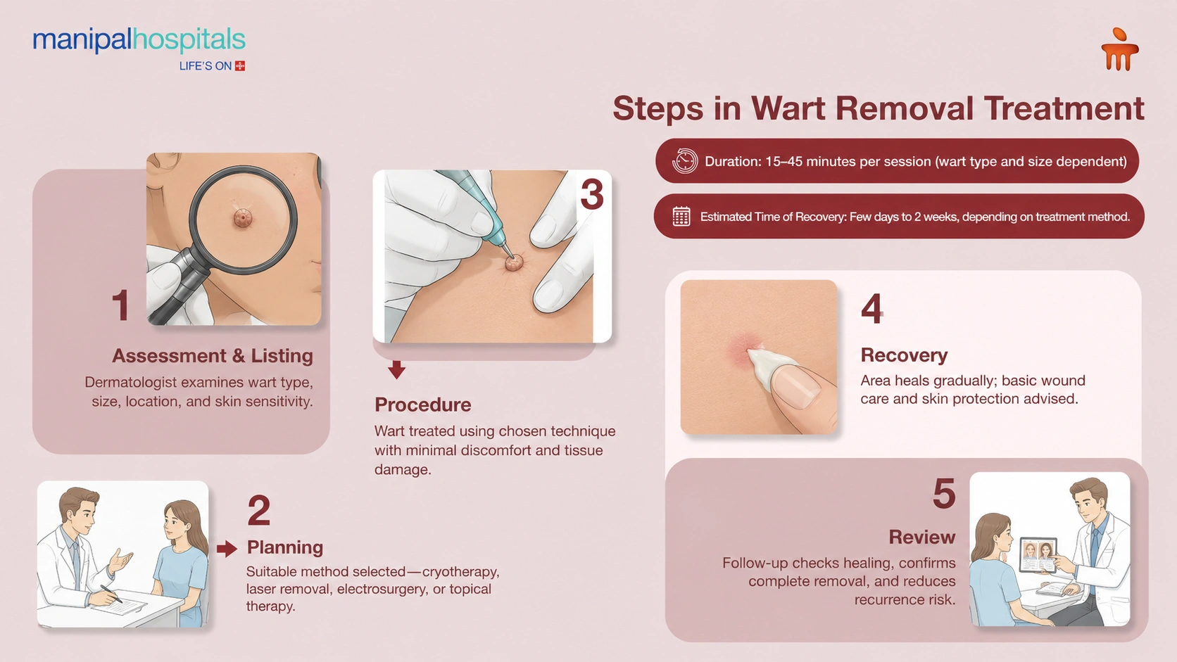 Wart Removal in Kolkata | Manipal Hospitals