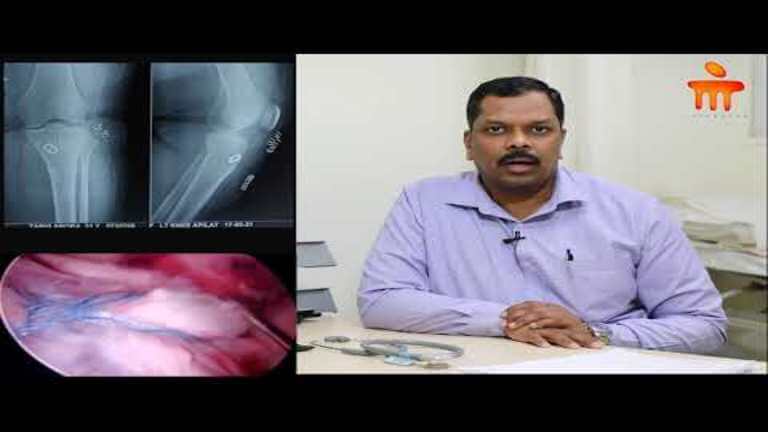 intra-articular-fracture_768x432_(1)1.jpg