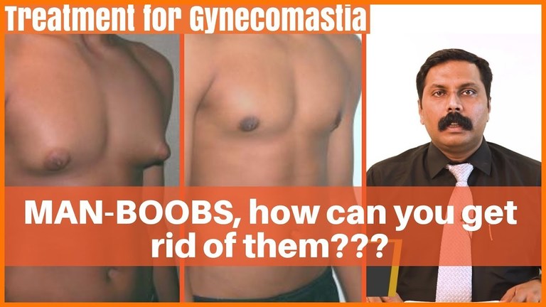what-is-gynecomastia-and-how-common-is-it-dr-sunil-kumar-ks_1_768x432.jpg