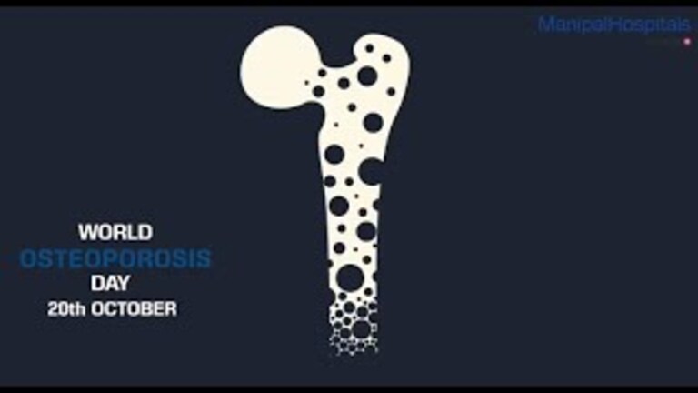 world-osteoporosis-day-2020.jpg