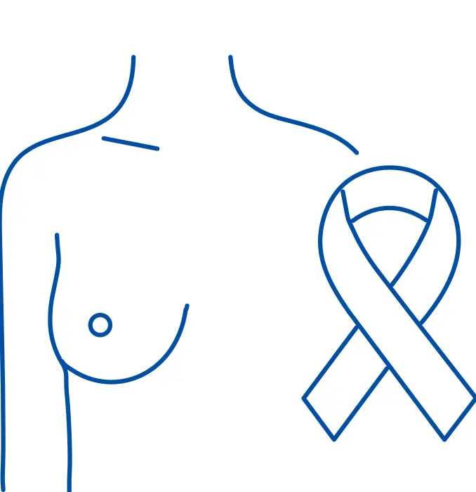 Breast Cancer Treatment in Vijayawada | Manipal Hospitals