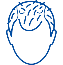 Hair Loss Treatment in Vijayawada | Manipal Hospitals