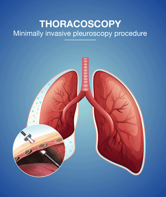 Pulmonology Treatment Hospital in Vijayawada