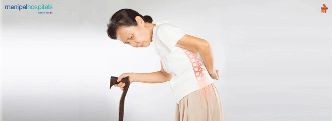 Osteoporosis Treatment in Whitefield Bangalore