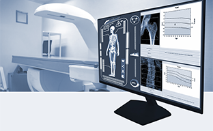 BMD | Whitefield | Manipal Hospitals