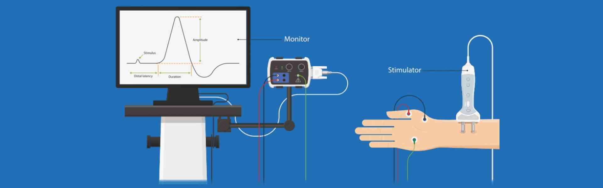 NCS - Nerve Conduction Study in Whitefield