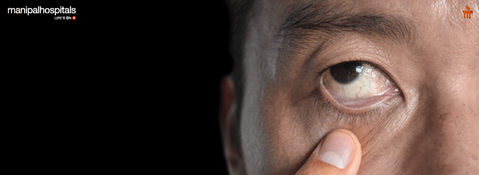 Paediatric Haematologist in Yeshwantpur