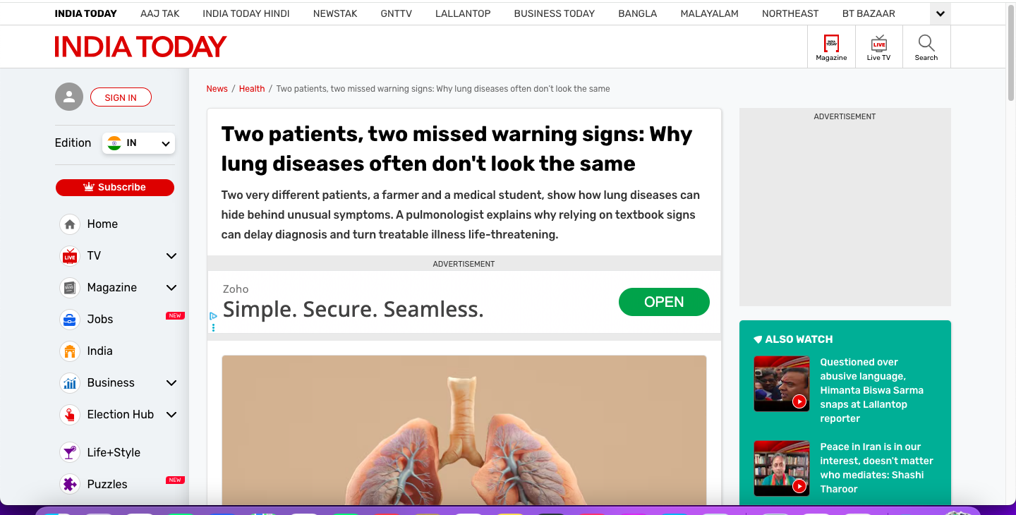 Two patients, two missed warning signs: Why lung diseases often don't look the same